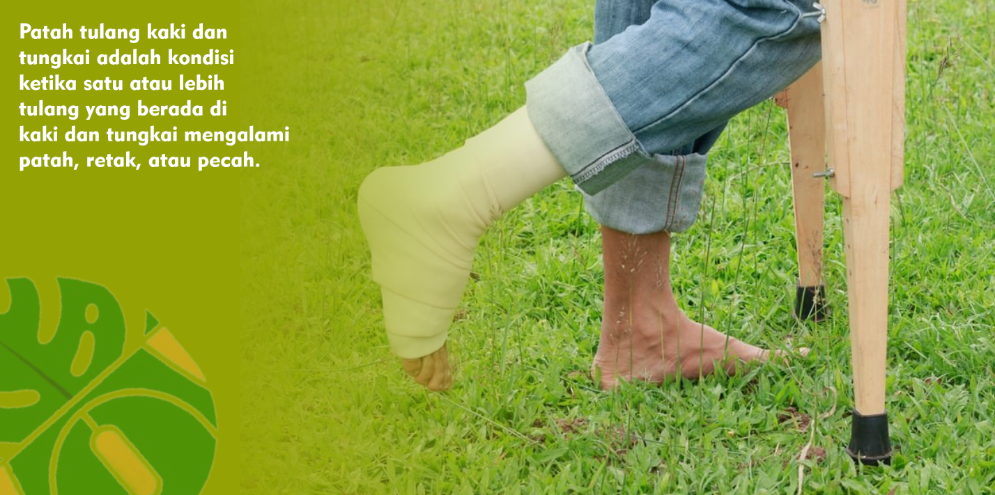 Beberapa Hal yang Perlu Diketahui Tentang Patah Kaki dan Tungkai Beberapa Hal yang Perlu Diketahui Tentang Patah Kaki dan Tungkai